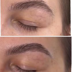 Before & after