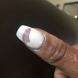 Is Gel polish supposed to peel? I got my nails done Friday and the next day my nails were peeling. Very Unhappy! Is Gel polish supposed to peel? I got my nails done Friday and the next day my nails were peeling. Very Unhappy!