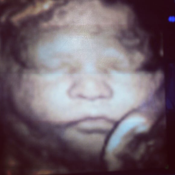 PEEKABOO IMAGING Updated September 2024 10900 Pines Blvd, Pembroke