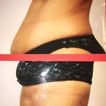 Spa Luna - Italian body toning and cellulite melting 10 sessions  No down time 3xs for 5 weeks $1000. (Reg $2000) Toned and trim for a New Year - Life Coach Near Me - Austin, Texas