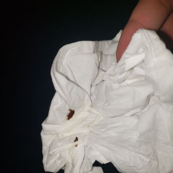 Courtyard by Marriott Ithaca Airport/University - Big smashed bed bug found after biting me - Hotels Near Me - Ithaca, New York