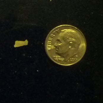 Appleseed Dental - The piece of my tooth left inside my gum! - General Dentistry Near Me - Leominster, Massachusetts Appleseed Dental - The piece of my tooth left inside my gum! - General Dentistry Near Me - Leominster, Massachusetts