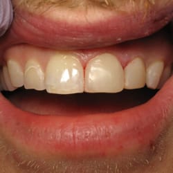 Valley Oaks Dental - After