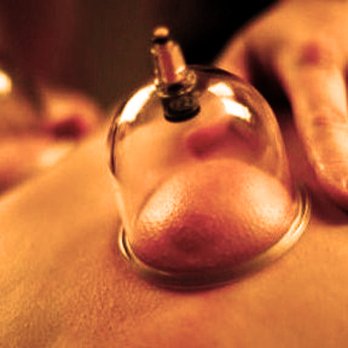 Tao Energy Movement - Cupping and very gentle experience. Relaxing the nervous system and aligning body. - Massage Therapy Near Me - Seattle, Washington Tao Energy Movement - Cupping and very gentle experience. Relaxing the nervous system and aligning body. - Massage Therapy Near Me - Seattle, Washington