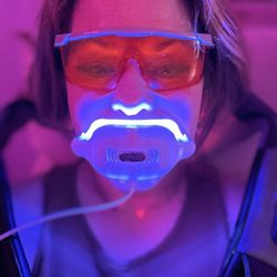 Coastal Opal Teeth Whitening