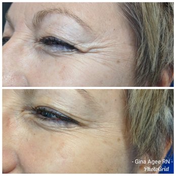 Essence Skin Spa - Botox - Medical Spas Near Me - Gilbert, Arizona