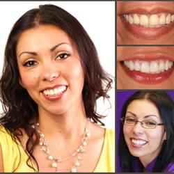 Nancy- Smilemakeover