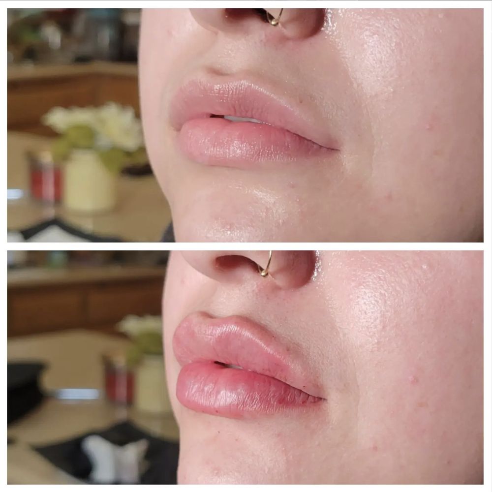 The Botox Spot Logo