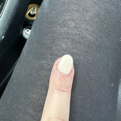 Star Nails & Spa - Crocked nail