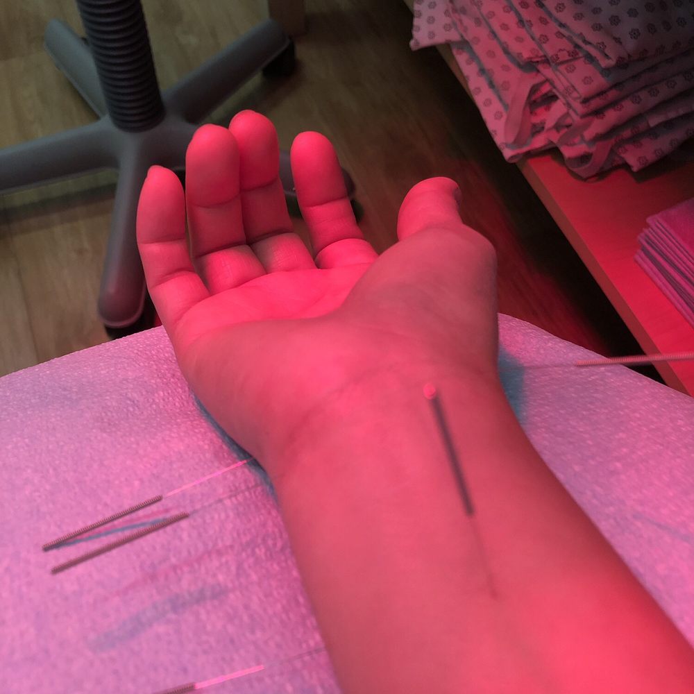 Concentra - Fourth session. This time, arm is propped up on a pillow. - Occupational Therapy Near Me - Murrieta, California