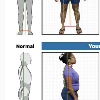 Spine Up Chiropractic - Chiropractors Near Me - Las Vegas, Nevada Spine Up Chiropractic - Chiropractors Near Me - Las Vegas, Nevada