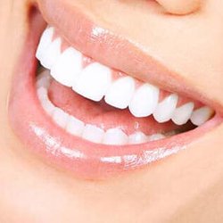 Family Smile Dental Center