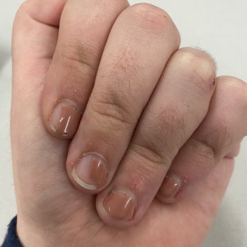 East Town Spa - Chipped nails - Day Spas Near Me - Milwaukee, Wisconsin