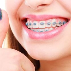 Buckeye Dental and Braces