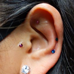 Jung Yun Acupuncture - Ear acupuncture for insomnia