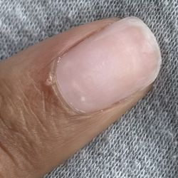 Lan Spa Nails & Tan - The hole that was drilled into my finger and how thin my nail was, you can see my flesh right underneath the top of my nail