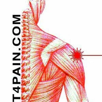 Laser Therapy for Pain - Sports Medicine Near Me - Sacramento, California Laser Therapy for Pain - Sports Medicine Near Me - Sacramento, California