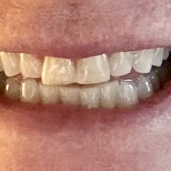 Care Dental - General Dentistry Near Me - Moorpark, California Care Dental - General Dentistry Near Me - Moorpark, California