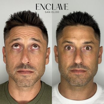 Enclave Med Spa - Botox - Laser Hair Removal Near Me - San Marcos, California Enclave Med Spa - Botox - Laser Hair Removal Near Me - San Marcos, California