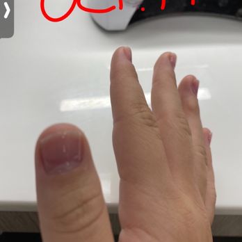Sunny Nails & Spa - Nails right after getting them pulled off, with a clear gloss. - Nail Salons Near Me - Norridge, Illinois Sunny Nails & Spa - Nails right after getting them pulled off, with a clear gloss. - Nail Salons Near Me - Norridge, Illinois
