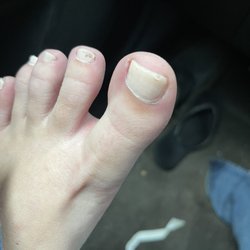 Fine Touch Nails - The pics showing the awful pedi says it all