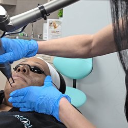 Noire Wellness and Aesthetics - Hollywood Carbon Peel