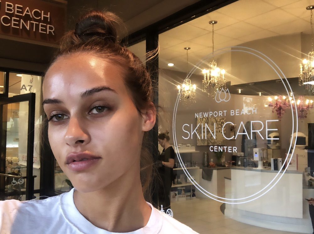 NEWPORT BEACH SKIN CARE CENTER 20 Photos & 85 Reviews Skin Care