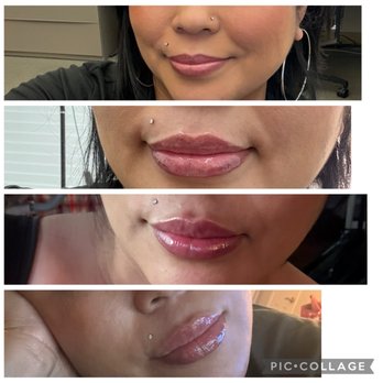 Essence by Shine - Versa Lips - Medical Spas Near Me Essence by Shine - Versa Lips - Medical Spas Near Me