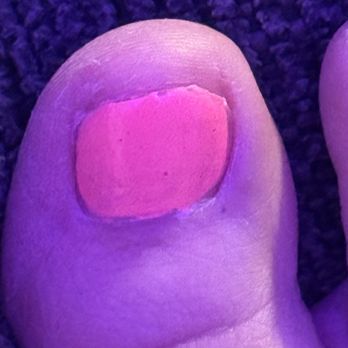 Blink Nails - Cracked and jagged nail - Nail Salons Near Me - Woodbridge, New Jersey