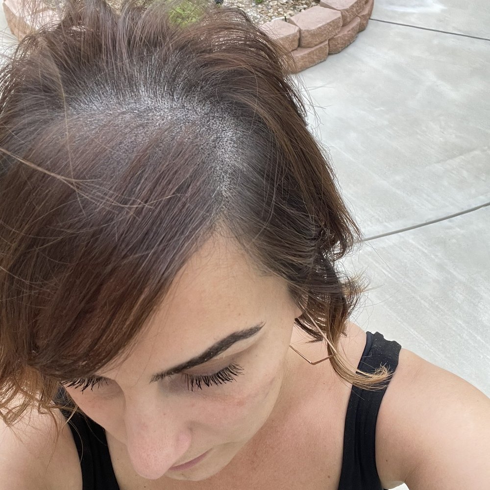 SMP INK - 4th session after 1st shampooing - Hair Loss Centers Near Me - Las Vegas, Nevada SMP INK - 4th session after 1st shampooing - Hair Loss Centers Near Me - Las Vegas, Nevada