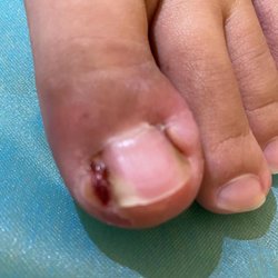 Big Feet