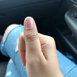 My infected thumb and the most crooked French manicure I have ever gotten.