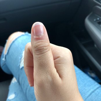 Anna Nails - My infected thumb and the most crooked French manicure I have ever gotten. - Nail Salons Near Me - Macomb, Michigan