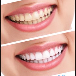 Radiant White Smiles of Austin