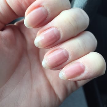 Pronails and Spa - Damaged beyond repair, cuticles completely ignored, base coat slapped on anyway. - Nail Salons Near Me - Gurnee, Illinois