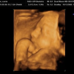 Moore Bradley, MD - 4-D Pictures