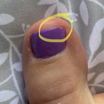 The Boujee Nails - Uneven big toe cut - Nail Salons Near Me - Fullerton, California The Boujee Nails - Uneven big toe cut - Nail Salons Near Me - Fullerton, California