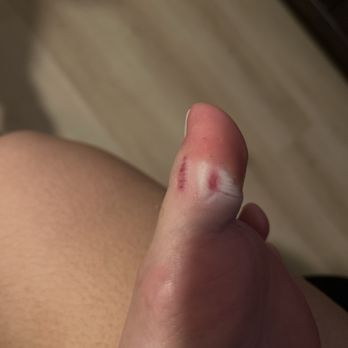 World Nails & Spa - Cut 24 hrs after pedicure - Nail Salons Near Me - Chula Vista, California World Nails & Spa - Cut 24 hrs after pedicure - Nail Salons Near Me - Chula Vista, California