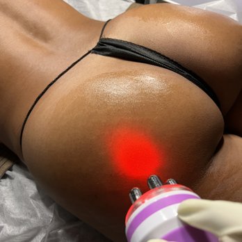 Nura NYC - Butt cupping includes wood therapy and radio frequency skin tightening to reduce cellulite and firm the skin - Waxing Near Me Nura NYC - Butt cupping includes wood therapy and radio frequency skin tightening to reduce cellulite and firm the skin - Waxing Near Me