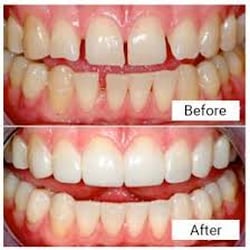 Premiere Dental Care Center