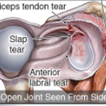 Bonilla Law Firm - Medical Illustration created for Bonilla Law Firm Case - Personal Injury Law Near Me - Austin, Texas