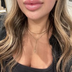 Aterna Wellness - Lip filler