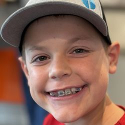 Goodman Orthodontics - 3 months into treatment