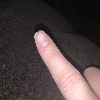 Lovely Nails - Torn nails - Nail Salons Near Me - Indian Harbour Beach, Florida Lovely Nails - Torn nails - Nail Salons Near Me - Indian Harbour Beach, Florida