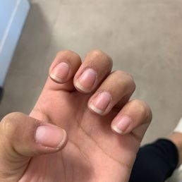 Dry around the nails and the clear nail polish was no longer on my nail due to it peeling off Dry around the nails and the clear nail polish was no longer on my nail due to it peeling off