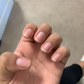 Royal Nails & Spa - Dry around the nails and the clear nail polish was no longer on my nail due to it peeling off - Nail Salons Near Me - Naples, Florida Royal Nails & Spa - Dry around the nails and the clear nail polish was no longer on my nail due to it peeling off - Nail Salons Near Me - Naples, Florida