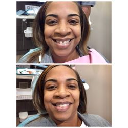 Morton Ranch Dental