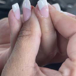 Cuts on finger Cuts on finger