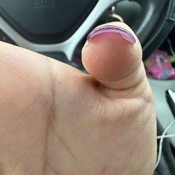 MPJ Nail Spa - Acrylic lump under the nail - Nail Salons Near Me - Monterey Park, California MPJ Nail Spa - Acrylic lump under the nail - Nail Salons Near Me - Monterey Park, California