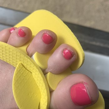 Pink & White Nails - Messy pedicure - Hair Removal Near Me - Denver, Colorado Pink & White Nails - Messy pedicure - Hair Removal Near Me - Denver, Colorado